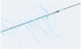 Cewniki do trombolizy AngioDynamics Uni Fuse