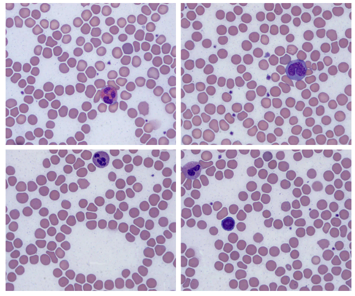 Cytowirówki ELITechGroup Aerospray®Hematology Stat