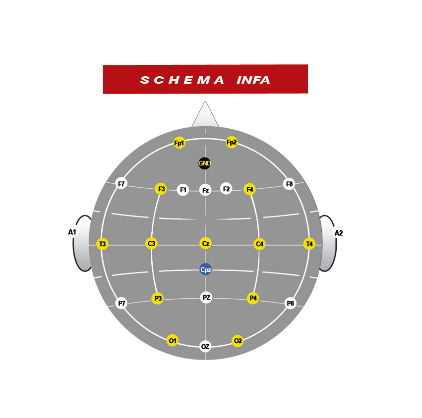 Czepki do elektroencefalografów (EEG) GVB Cup