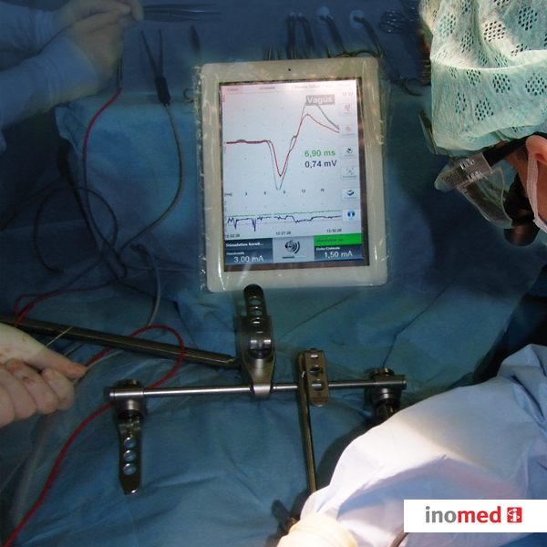 Czujniki prądu do aparatów do neuromonitoringu śródoperacyjnego inomed Medizintechnik GmbH Mute Sensor