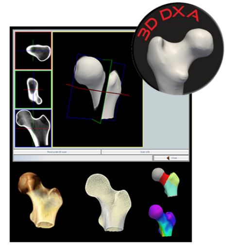 Densytometry rentgenowskie DMS Stratos