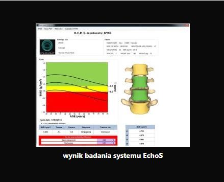 Densytometry ultradźwiękowe Echolight EchoS