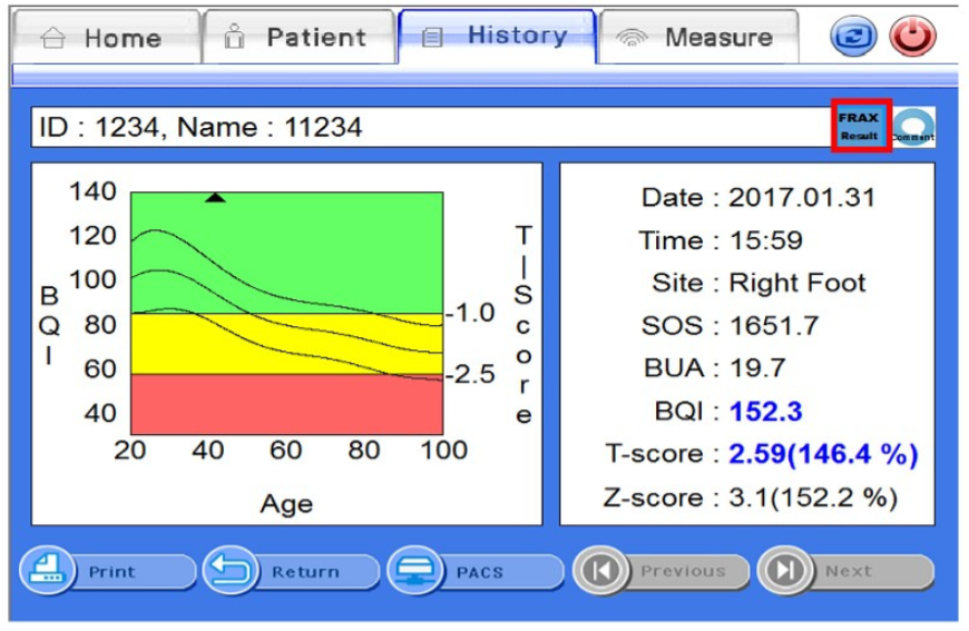 Densytometry ultradźwiękowe Medical ECONET inus S
