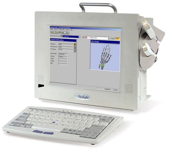 Densytometry ultradźwiękowe Sunlight Omnisense 7000S