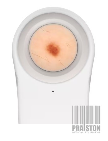 Dermatoskopy ręczne CASIO DZ-S50
