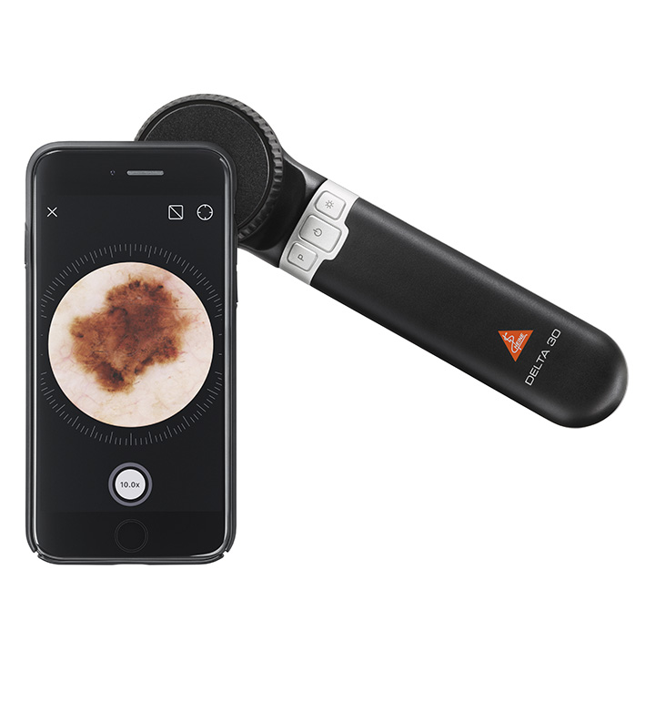 Dermatoskopy ręczne Heine Delta 30