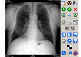 Detektory RTG cyfrowe Italray XFM