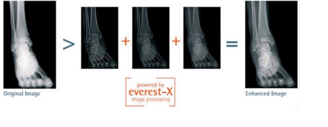 Detektory RTG cyfrowe Italray XFM