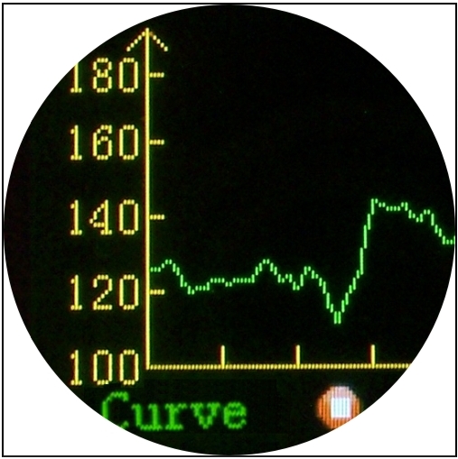 Detektory tętna płodu Shenzhen Aeon Technology Co., Ltd A-100C