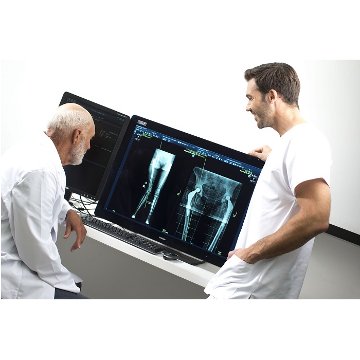 Diagnostyka obrazowa - oprogramowanie AGFA Enterprise Imaging Radiology