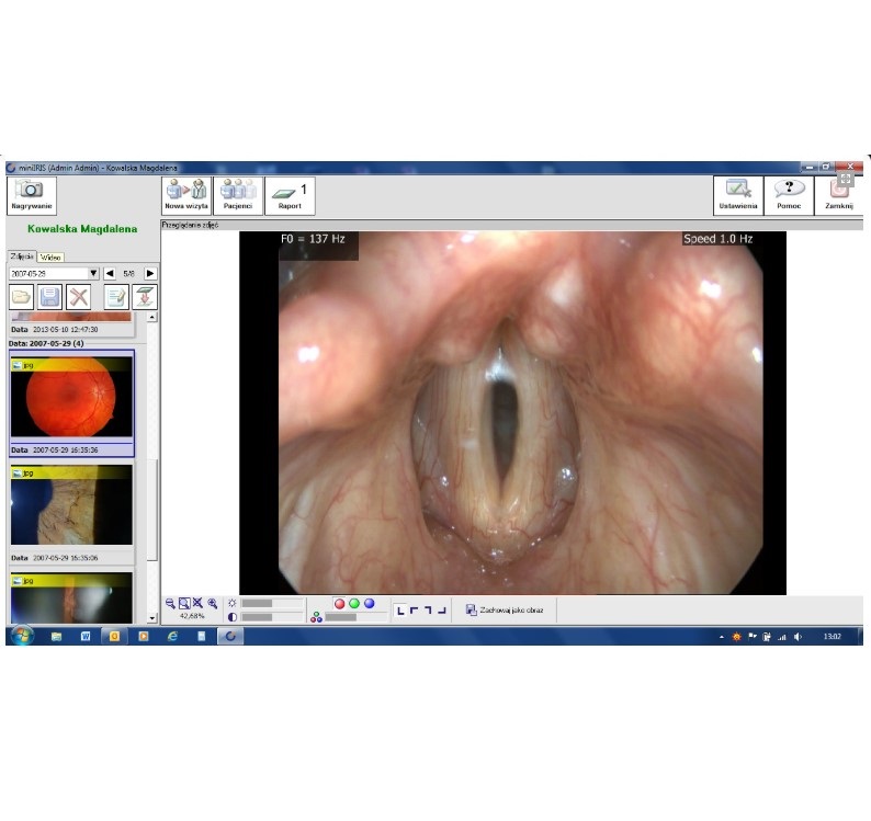 Diagnostyka obrazowa - oprogramowanie B/D IRIS