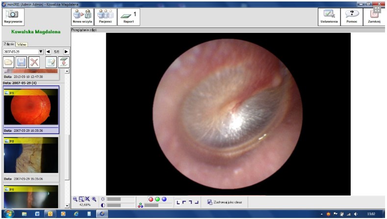 Diagnostyka obrazowa - oprogramowanie B/D IRIS