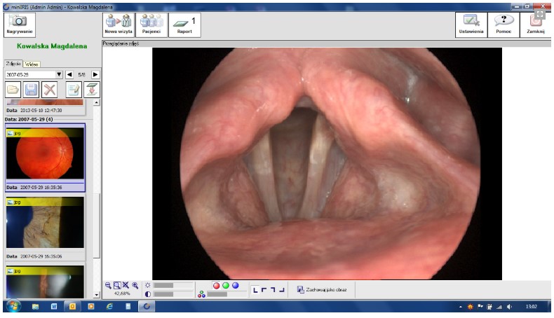 Diagnostyka obrazowa - oprogramowanie B/D IRIS