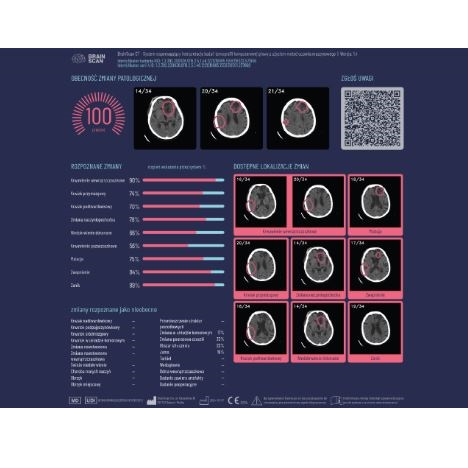 Diagnostyka obrazowa - oprogramowanie BrainScan BrainScan CT