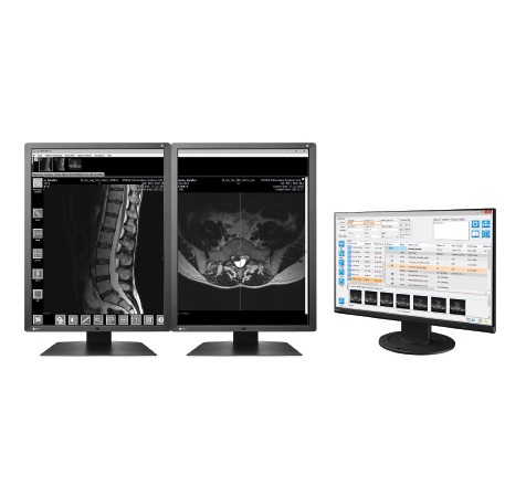 Diagnostyka obrazowa - oprogramowanie Image Information System IQ-VIEW / PRO