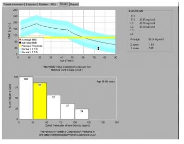 Diagnostyka obrazowa - oprogramowanie Mindways Software QCT Pro