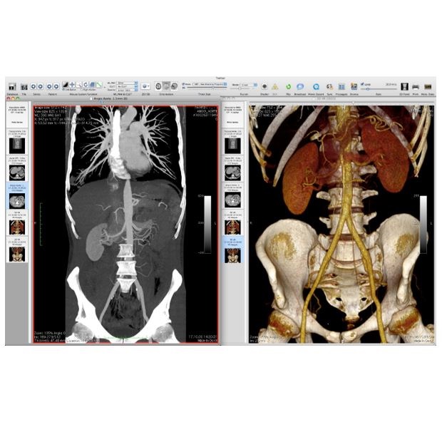 Diagnostyka obrazowa - oprogramowanie Osirix OsiriX MD