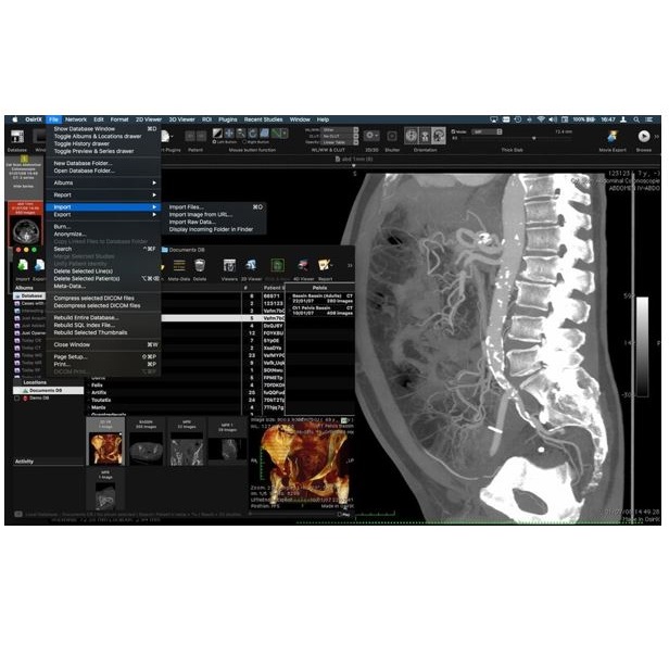 Diagnostyka obrazowa - oprogramowanie Osirix OsiriX MD