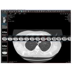 Diagnostyka obrazowa - oprogramowanie Synektik ArView