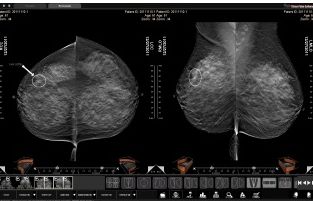 Diagnostyka obrazowa - oprogramowanie Three Palm Software Three Palm