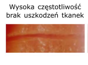 Diatermie chirurgiczne - Aparaty elektrochirurgiczne Loktal Wavetronic 6000 Touch