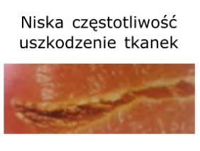 Diatermie chirurgiczne - Aparaty elektrochirurgiczne Loktal Wavetronic 6000 Touch