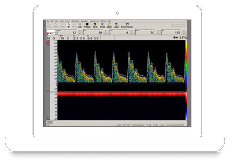 Dopplery naczyń czaszkowych i szyjnych DWL Multi DOP T digital