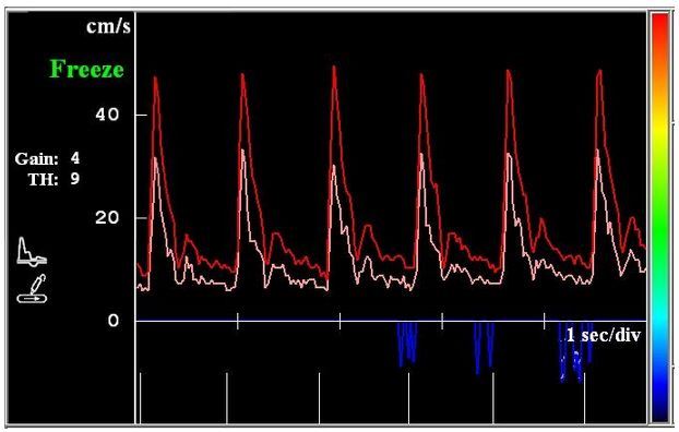 Dopplery naczyń obwodowych Hadeco DVM-4500