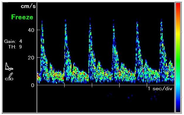 Dopplery naczyń obwodowych Hadeco DVM-4500