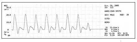 Dopplery naczyń obwodowych Hadeco SmartDop 45