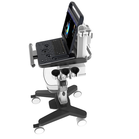 Echokardiografy - UKG CHISON EBit 60