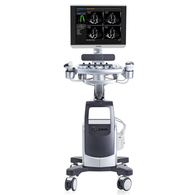Echokardiografy - UKG CHISON QBit 9