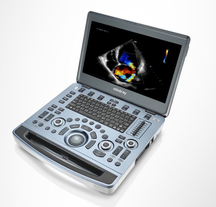 Echokardiografy - UKG MINDRAY M8