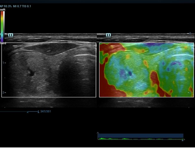 Echokardiografy - UKG MINDRAY Resona 7