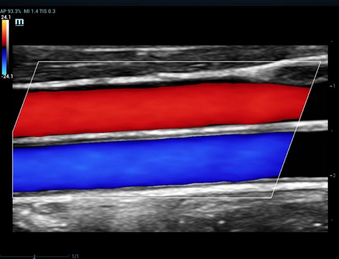 Echokardiografy - UKG MINDRAY Resona 7