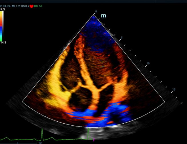 Echokardiografy - UKG MINDRAY Resona 7