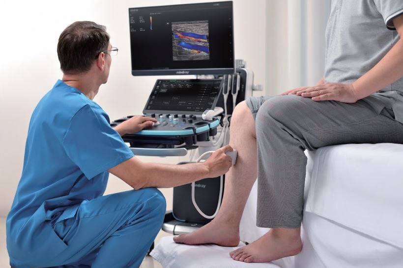 Echokardiografy - UKG MINDRAY Resona I9