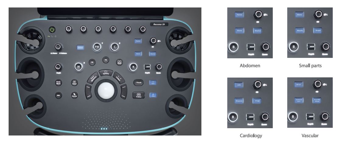 Echokardiografy - UKG MINDRAY Resona I9