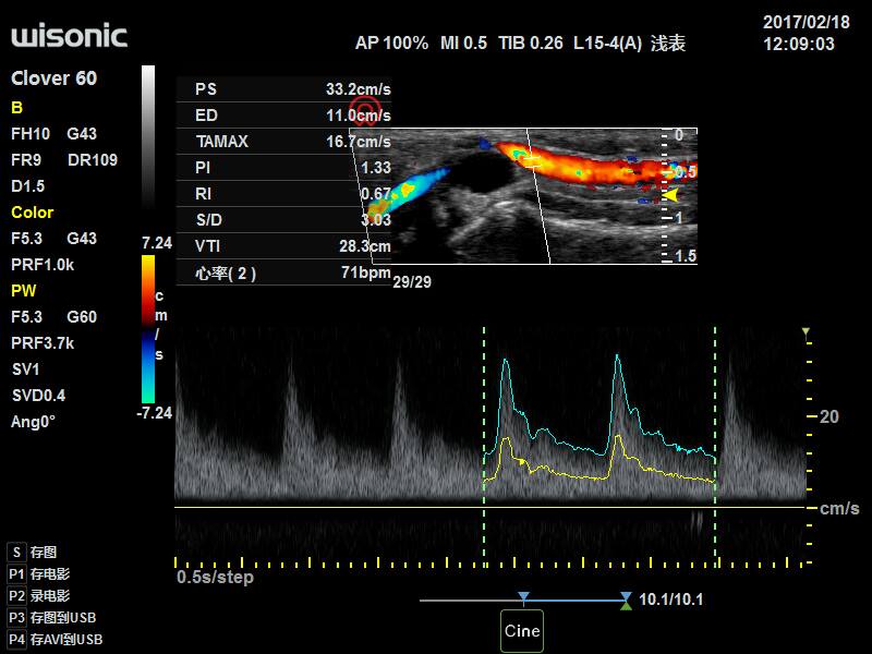 Echokardiografy - UKG Wisonic Clover 60