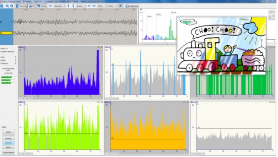 EEG Biofeedback (neurofeedback) Koordynacja Zestaw nr 4 EEG Biofeedback 5 kanałowy – Kompleksowe wyposażenie