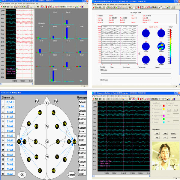 Elektroencefalografy (EEG) CONTEC KT88-2400