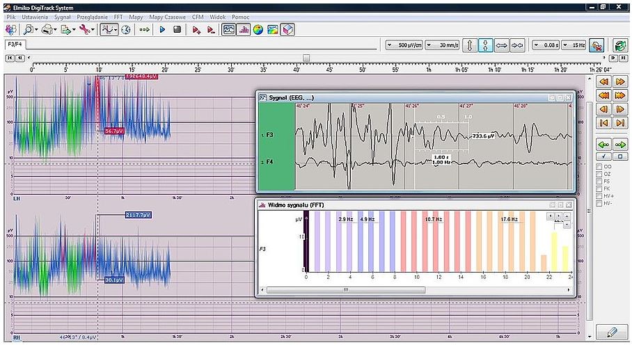 Elektroencefalografy (EEG) ELMIKO DigiTrack CCFM