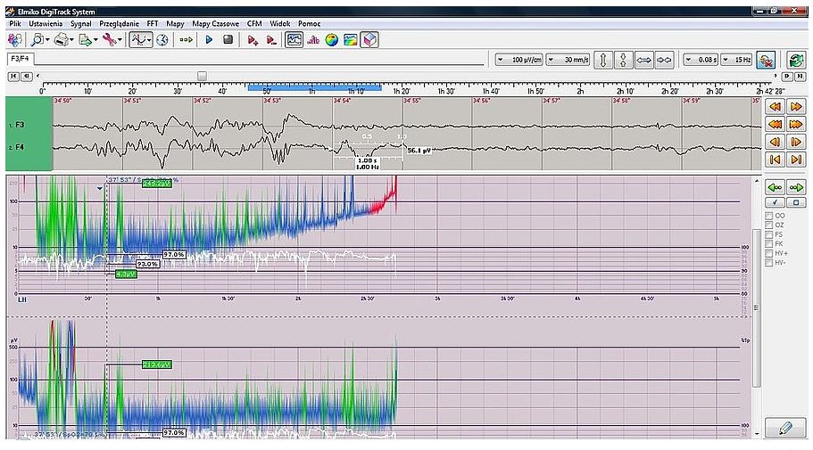 Elektroencefalografy (EEG) ELMIKO DigiTrack CCFM