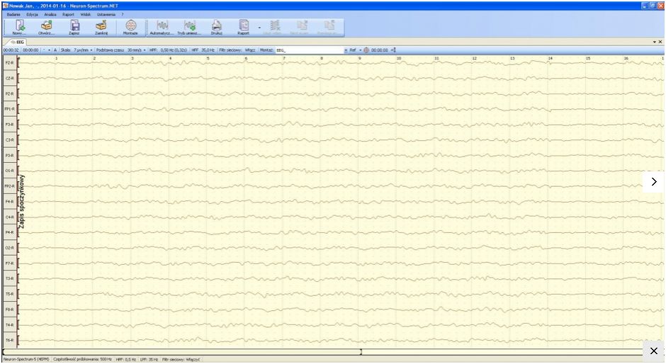 Elektroencefalografy (EEG) Neurosoft Neuron Spectrum 4/EPM
