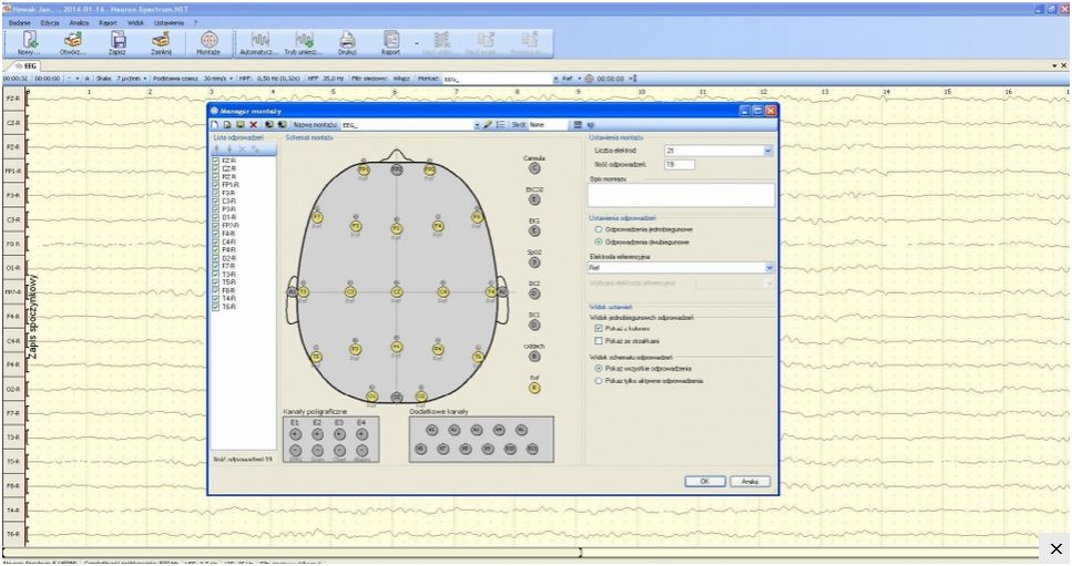 Elektroencefalografy (EEG) Neurosoft Neuron Spectrum 4/EPM