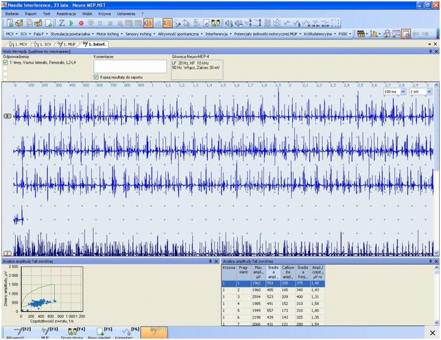 Elektromiografy (EMG) Neurosoft Neuro-EMG-micro
