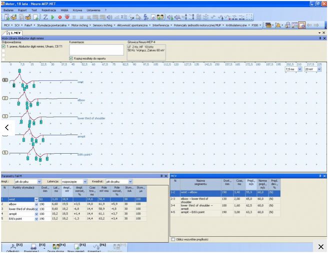 Elektromiografy (EMG) Neurosoft Neuro-Mep-4