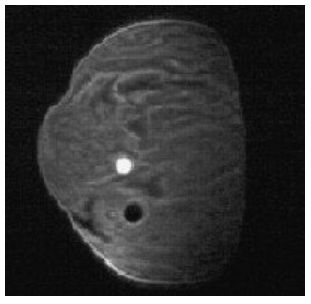 Fantomy do biopsji FLUKE Potrójnej modalności