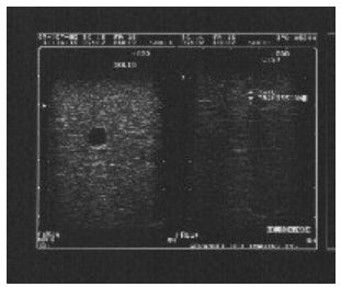Fantomy do biopsji FLUKE Potrójnej modalności