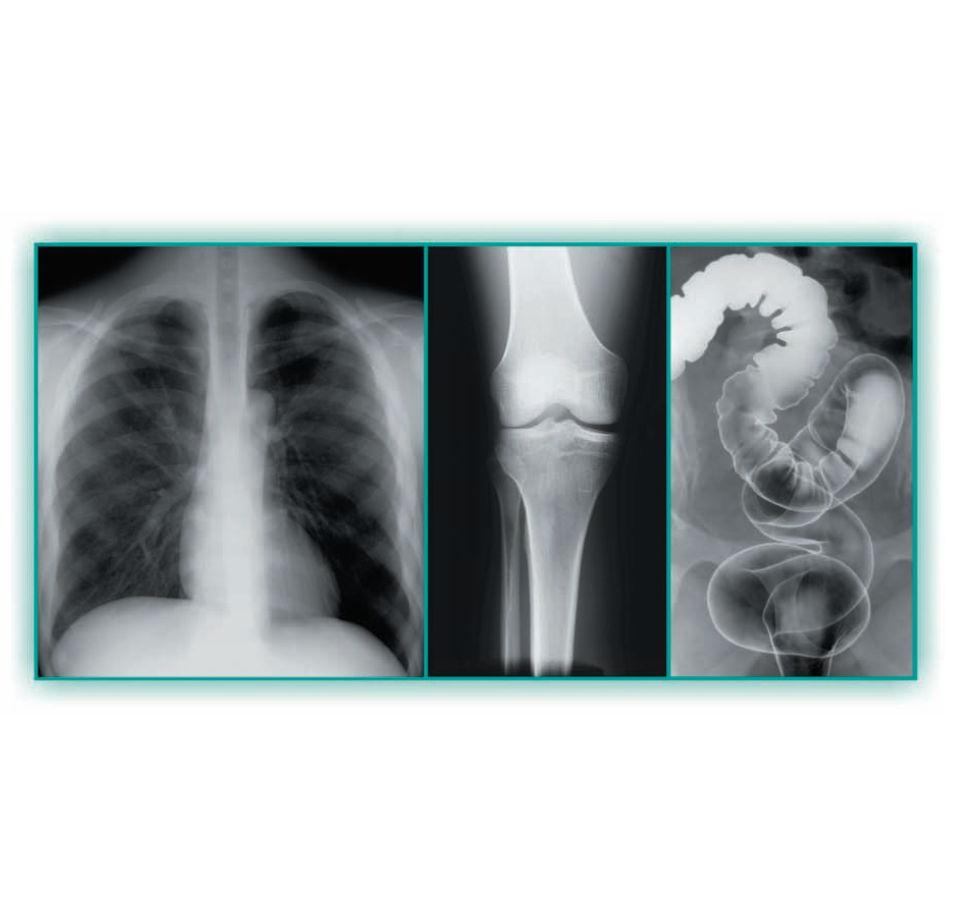 Filmy RTG – ogólnodiagnostyczne Carestream MXG